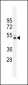 CRFR2 Antibody (D35)